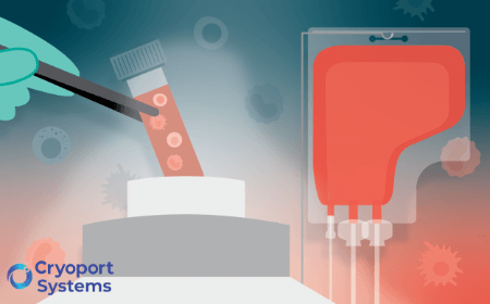 Preserving the future of medicine: standardizing leukapheresis materials with cryopreservation for scalable cell therapies