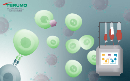 Closed and automated CAR-T production: a fast, simple workflow for high-dose, high-quality cells