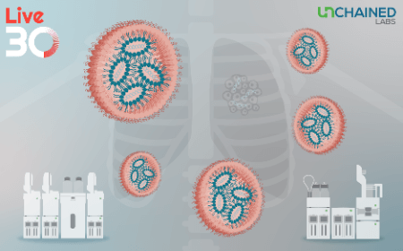 Engineering lipid nanoparticles for lung cancer imaging