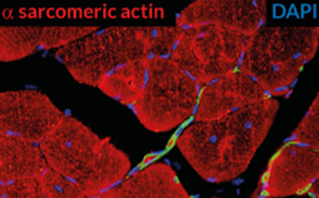 Successful ex vivo expansion of  pro-angiogenic cells from one single primitive HSC