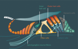 Progressing towards a cure for deafness through gene therapy